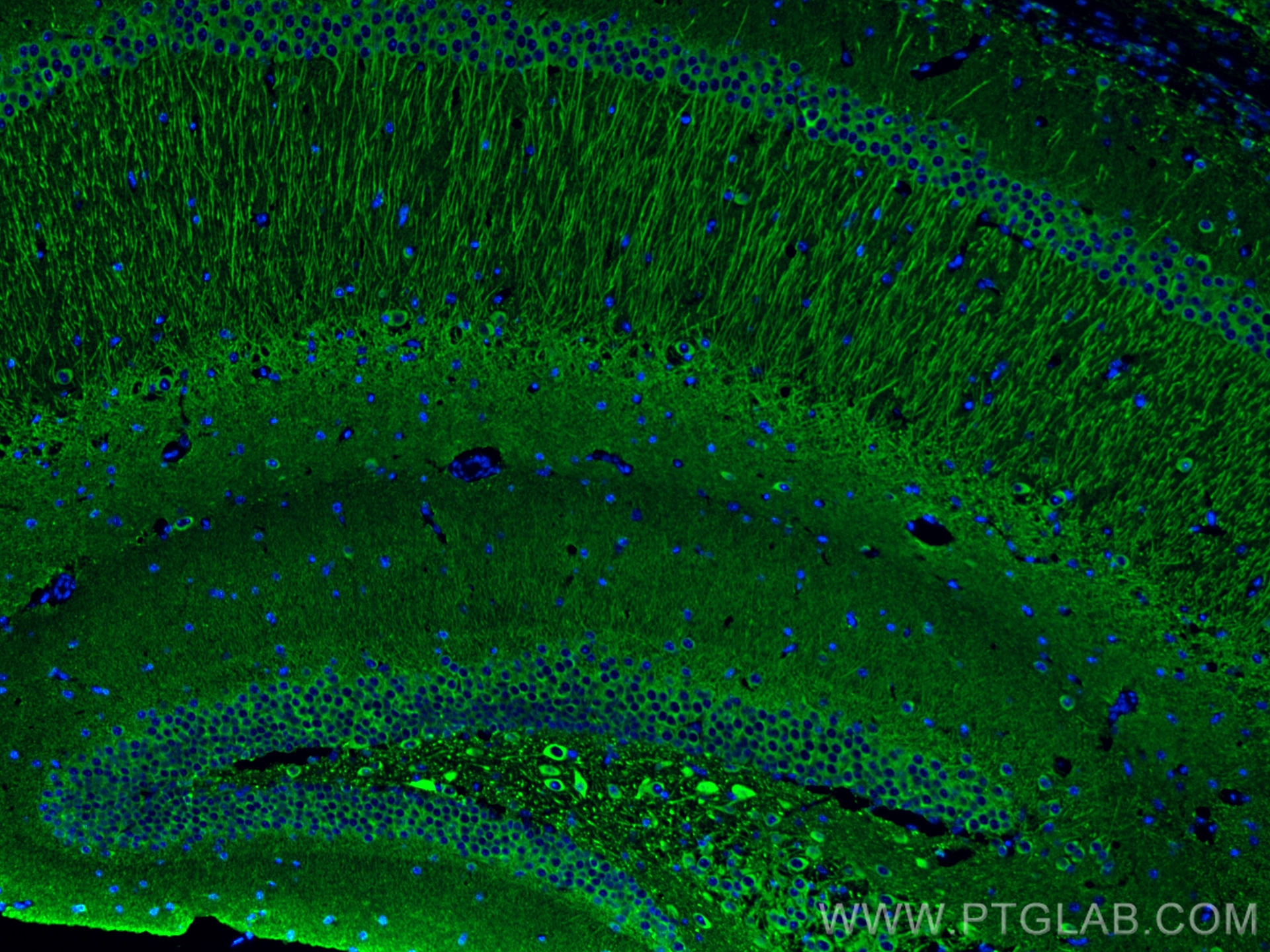 Immunofluorescence (IF) / fluorescent staining of mouse brain tissue using MAP2 Polyclonal antibody (17490-1-AP)