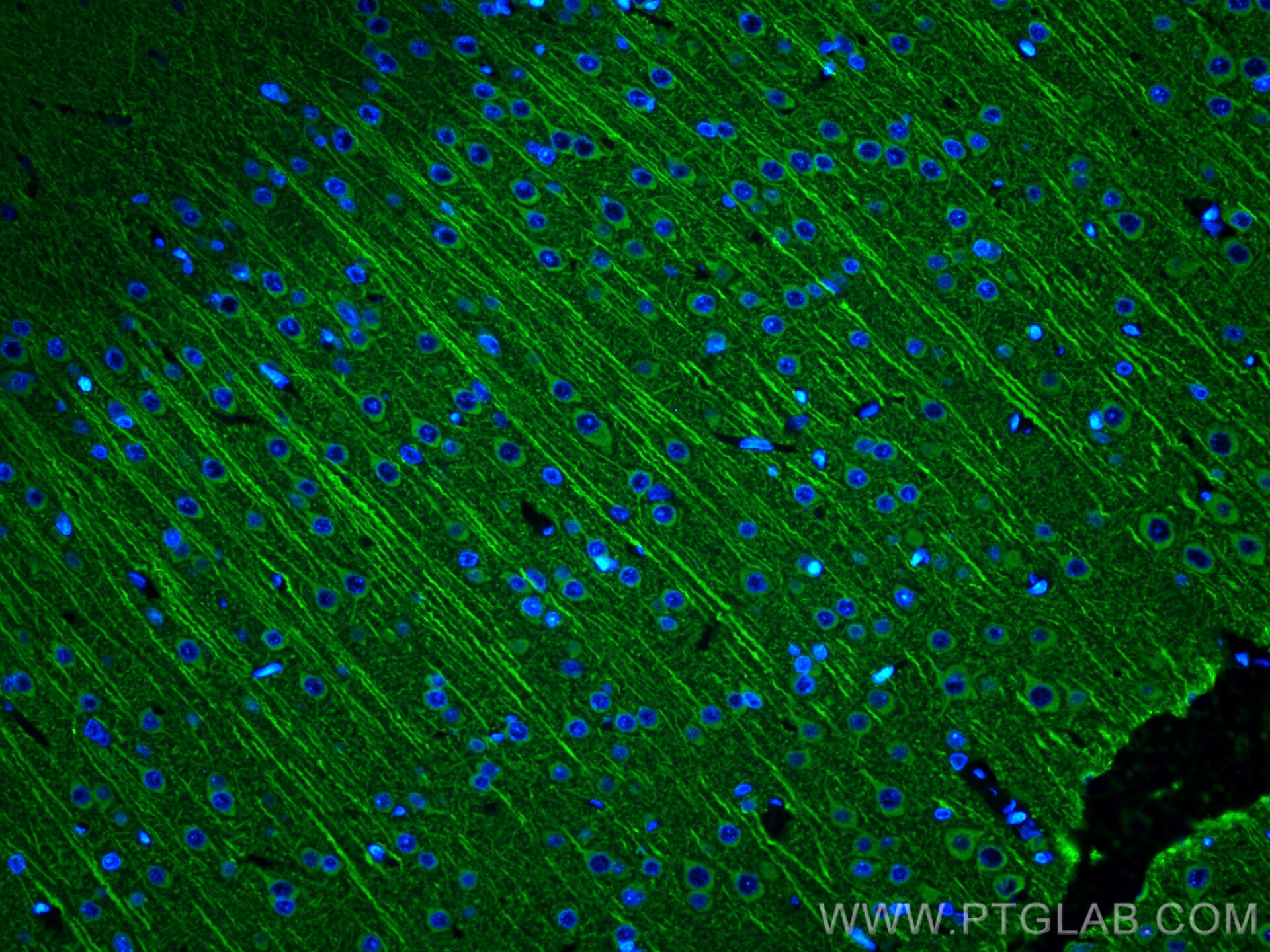 IF Staining of rat brain using 17490-1-AP