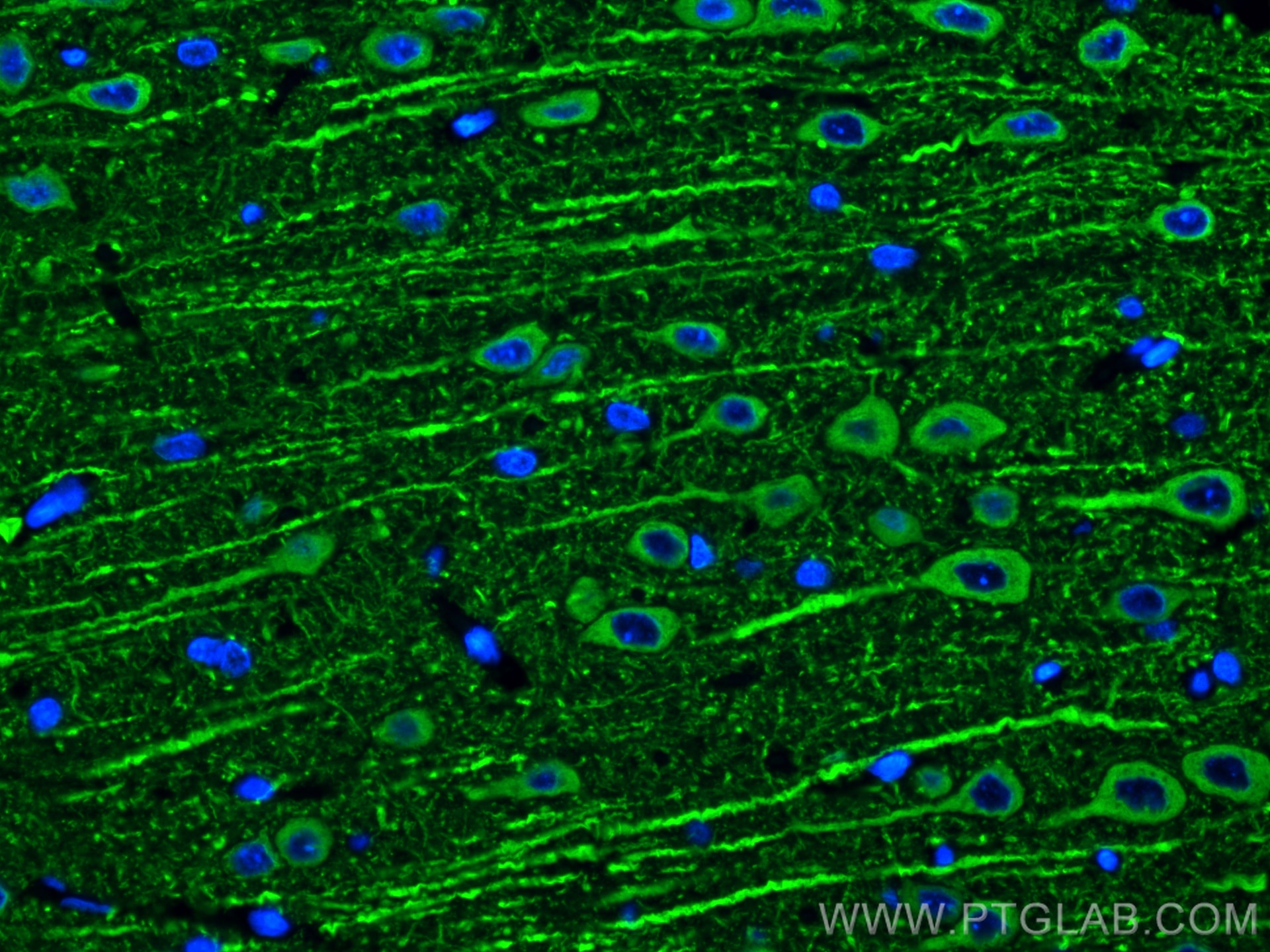 Immunofluorescence (IF) / fluorescent staining of rat brain tissue using MAP2 Polyclonal antibody (17490-1-AP)