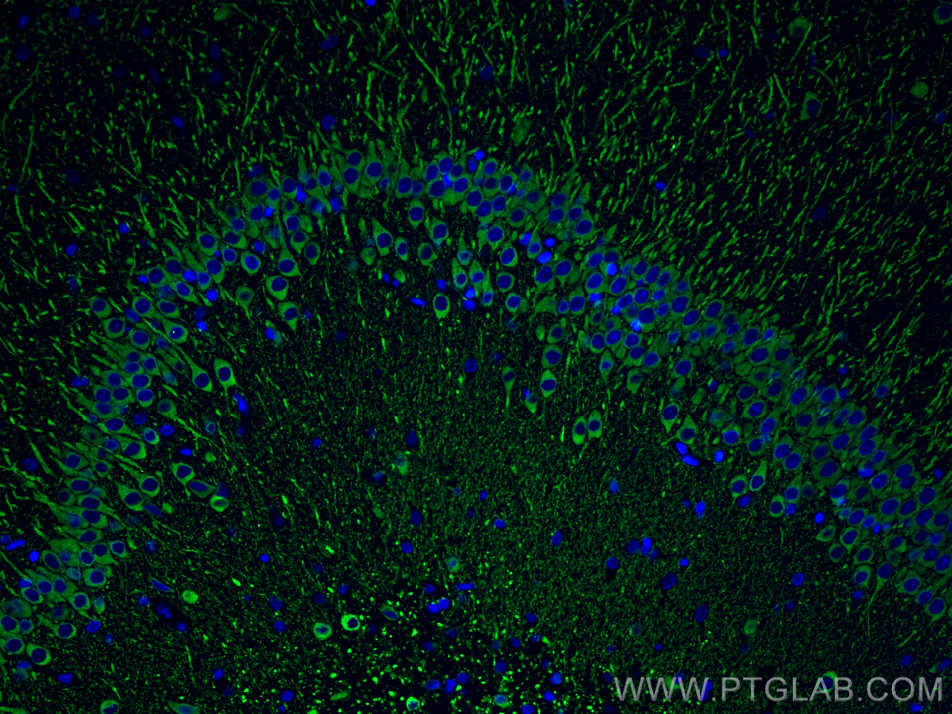 IF Staining of rat brain using 17490-1-AP