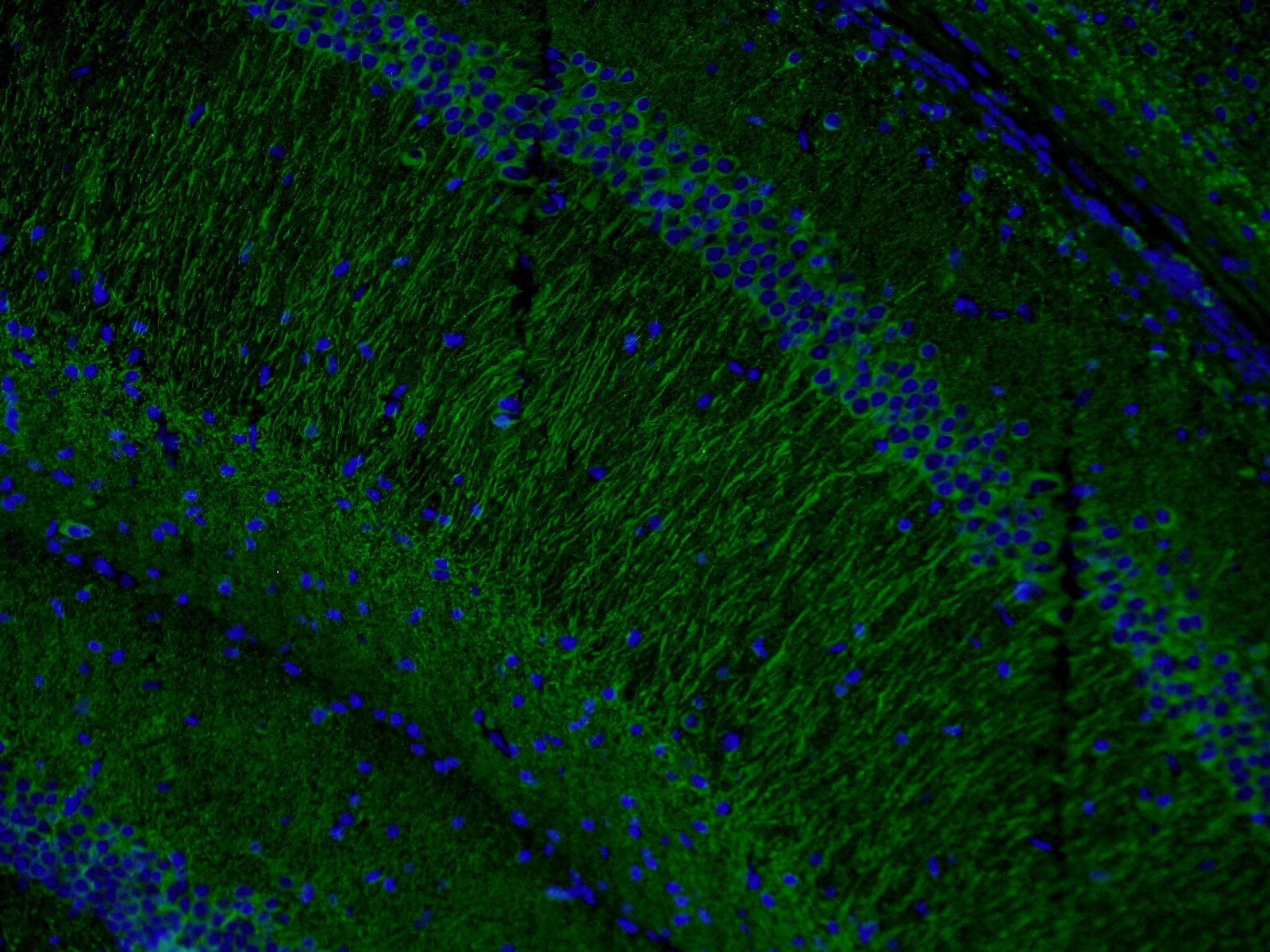 MAP2 Polyclonal antibody