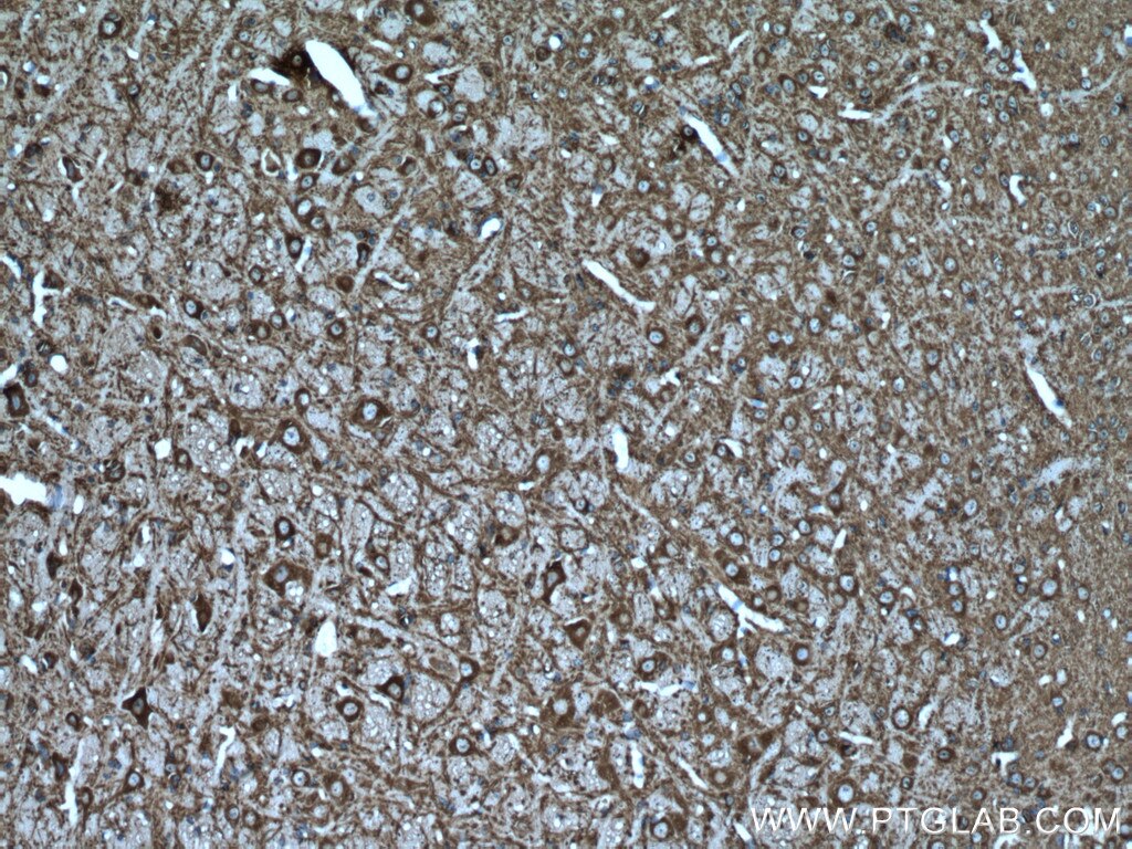 Immunohistochemistry (IHC) staining of mouse cerebellum tissue using MAP2 Polyclonal antibody (17490-1-AP)