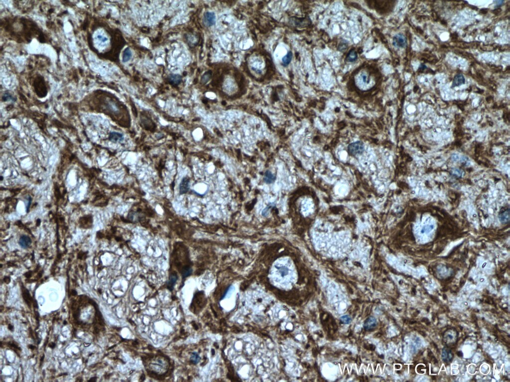 Immunohistochemistry (IHC) staining of mouse cerebellum tissue using MAP2 Polyclonal antibody (17490-1-AP)