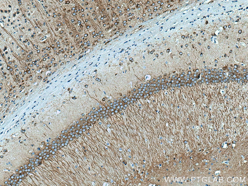 Immunohistochemistry (IHC) staining of mouse brain tissue using MAP2 Polyclonal antibody (17490-1-AP)