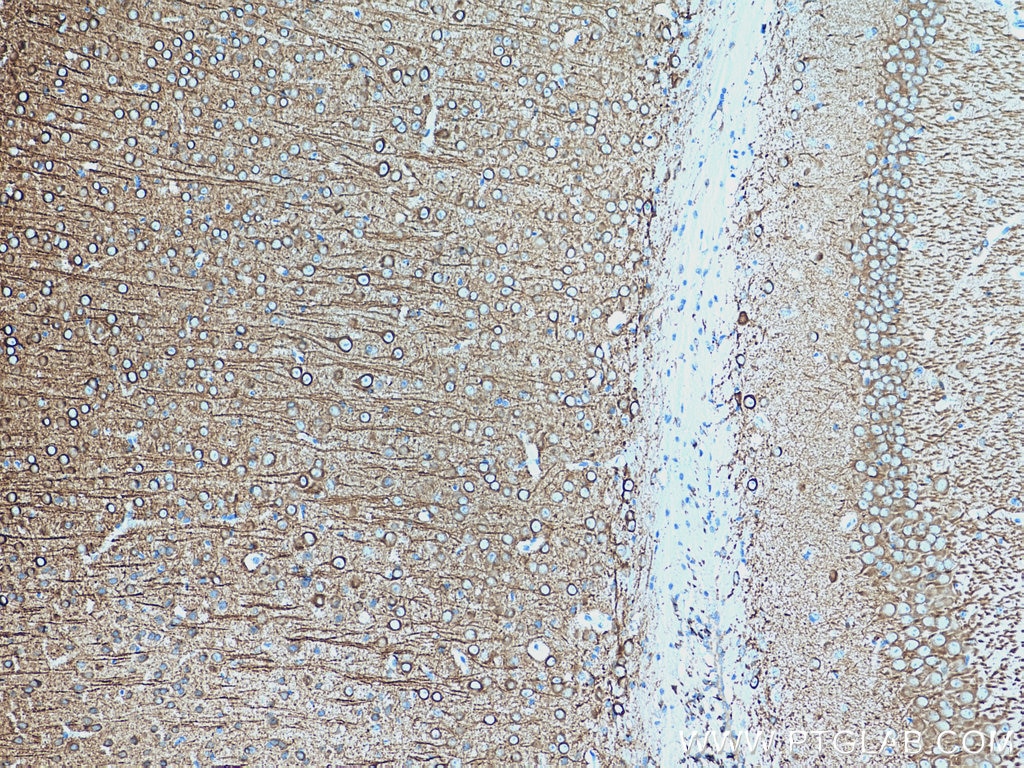 IHC staining of mouse brain using 17490-1-AP