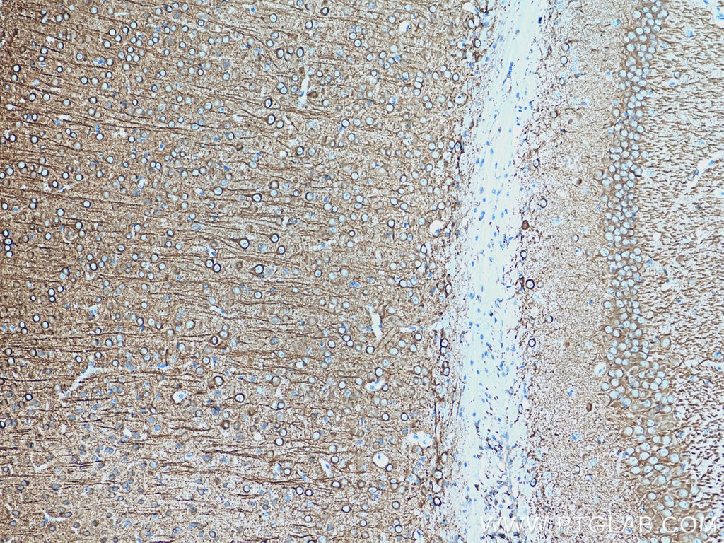 Immunohistochemistry (IHC) staining of mouse brain tissue using MAP2 Polyclonal antibody (17490-1-AP)