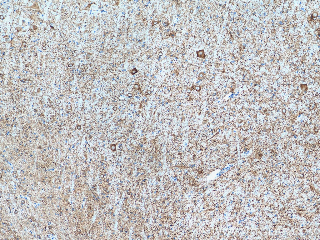 Immunohistochemistry (IHC) staining of rat brain tissue using MAP2 Polyclonal antibody (17490-1-AP)