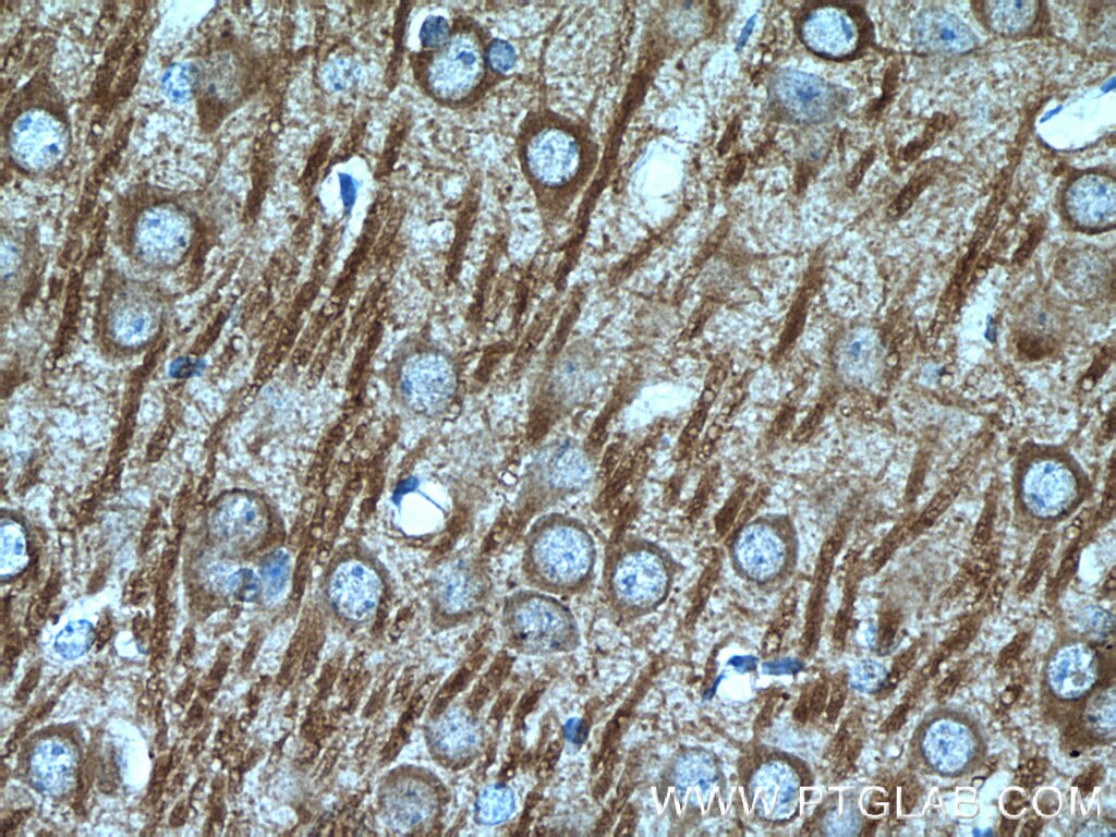 Immunohistochemistry (IHC) staining of rat brain tissue using MAP2 Polyclonal antibody (17490-1-AP)