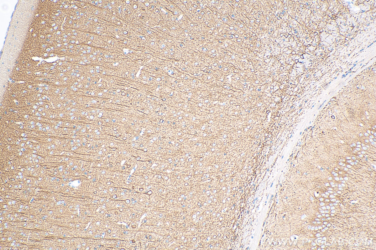 Immunohistochemistry (IHC) staining of mouse brain tissue using MAP2 Polyclonal antibody (17490-1-AP)