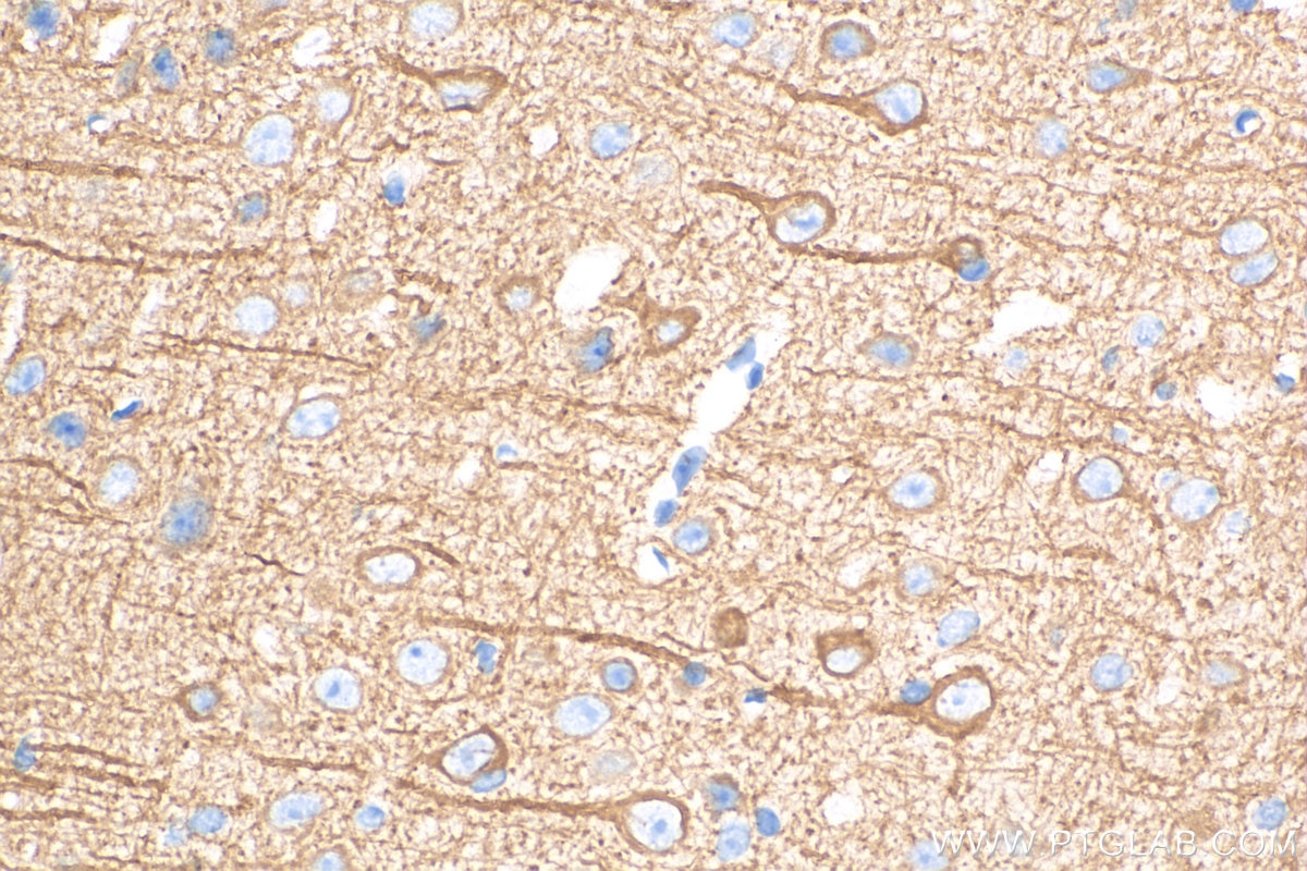 Immunohistochemistry (IHC) staining of mouse brain tissue using MAP2 Polyclonal antibody (17490-1-AP)
