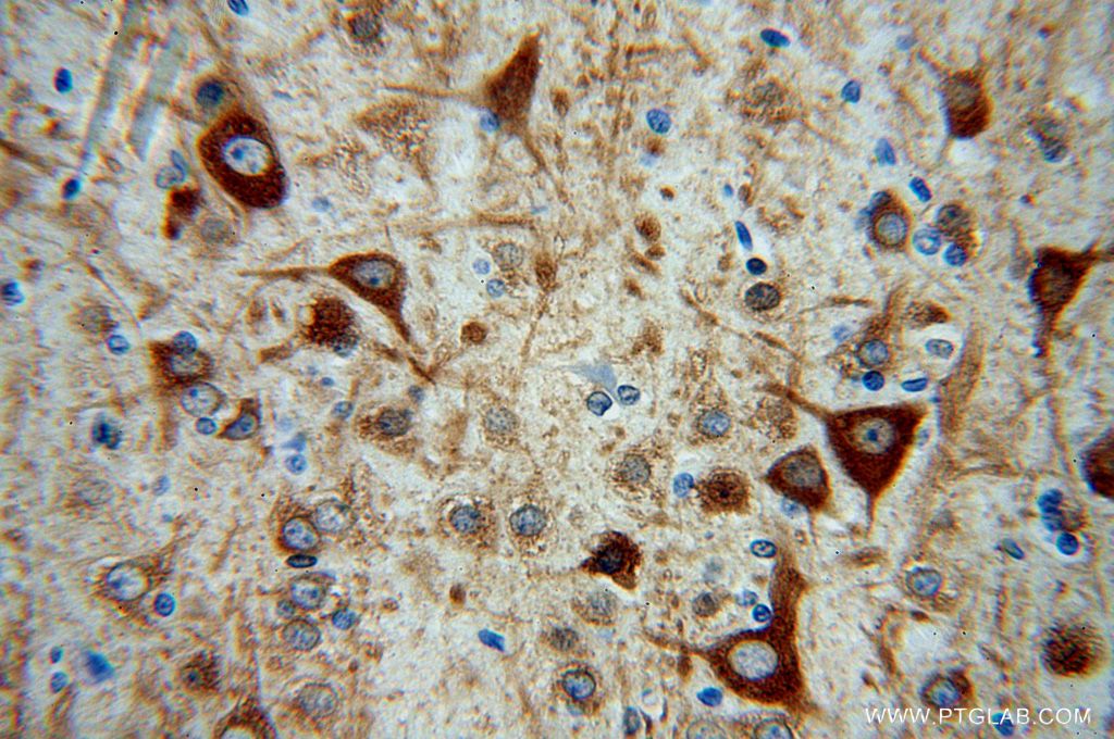 Immunohistochemistry (IHC) staining of human brain tissue using MAP2 Polyclonal antibody (17490-1-AP)