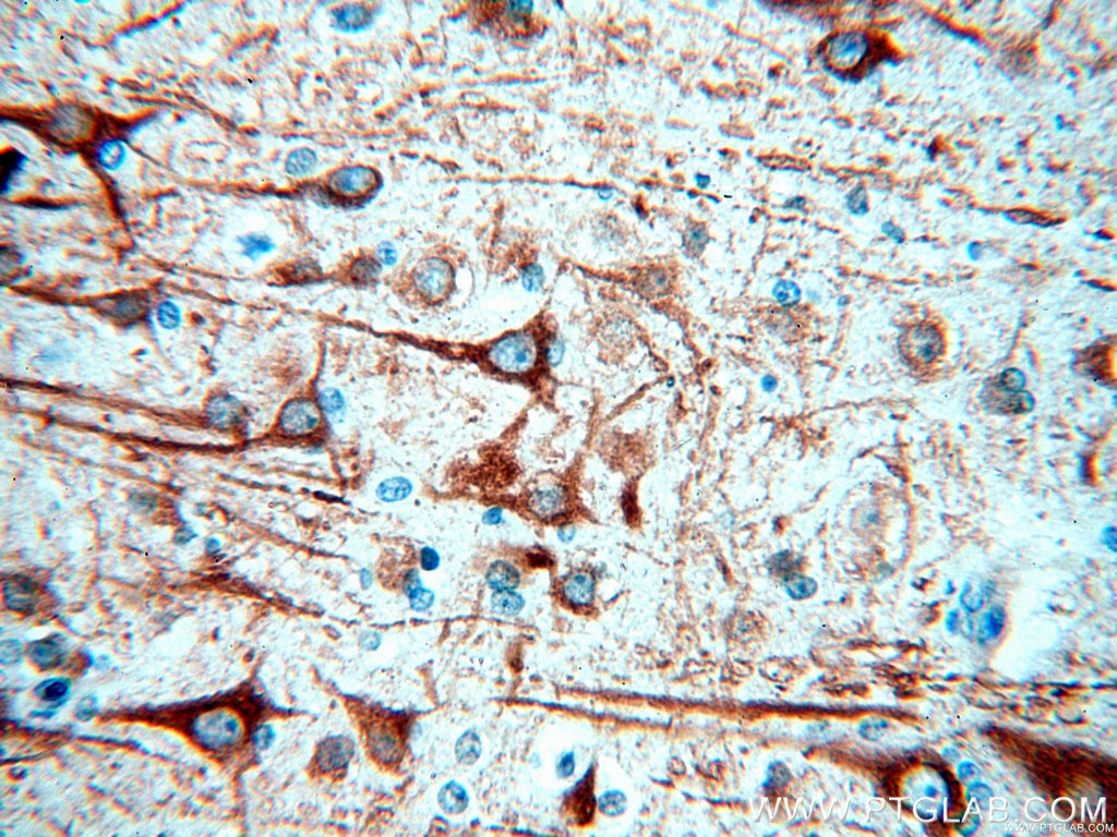 MAP2 Polyclonal antibody