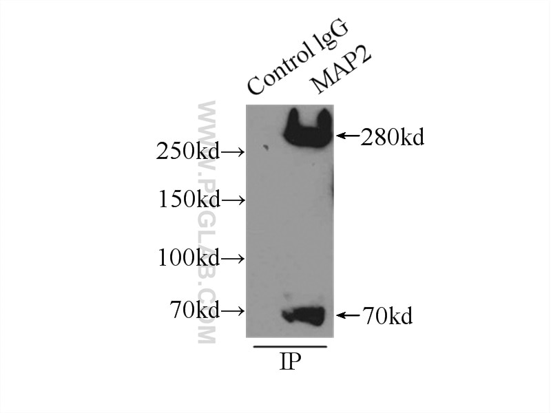 Immunoprecipitation (IP) experiment of mouse brain tissue using MAP2 Polyclonal antibody (17490-1-AP)