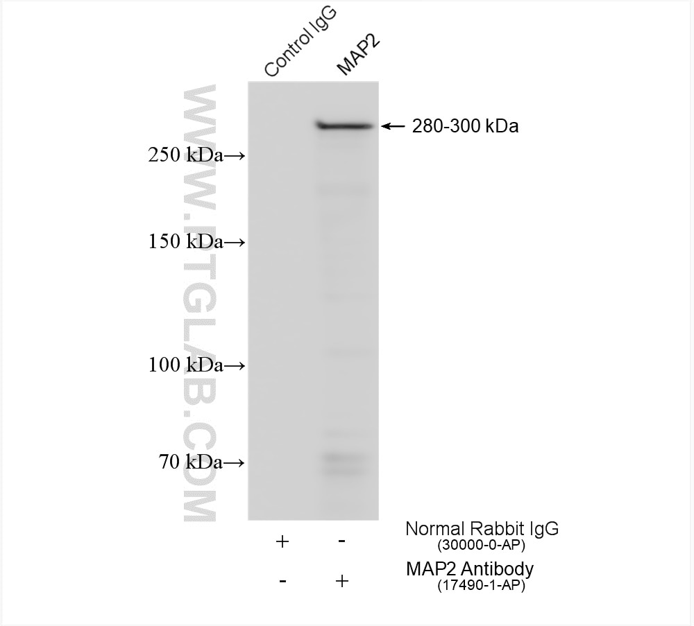 Immunoprecipitation (IP) experiment of mouse brain tissue using MAP2 Polyclonal antibody (17490-1-AP)