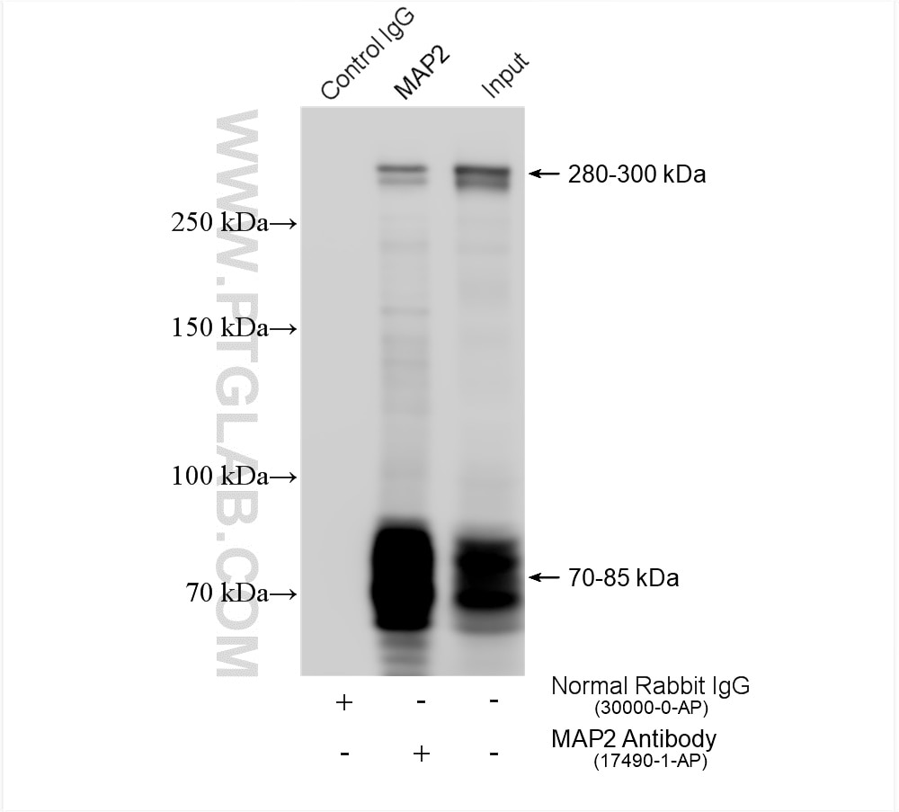 Immunoprecipitation (IP) experiment of SH-SY5Y cells using MAP2 Polyclonal antibody (17490-1-AP)