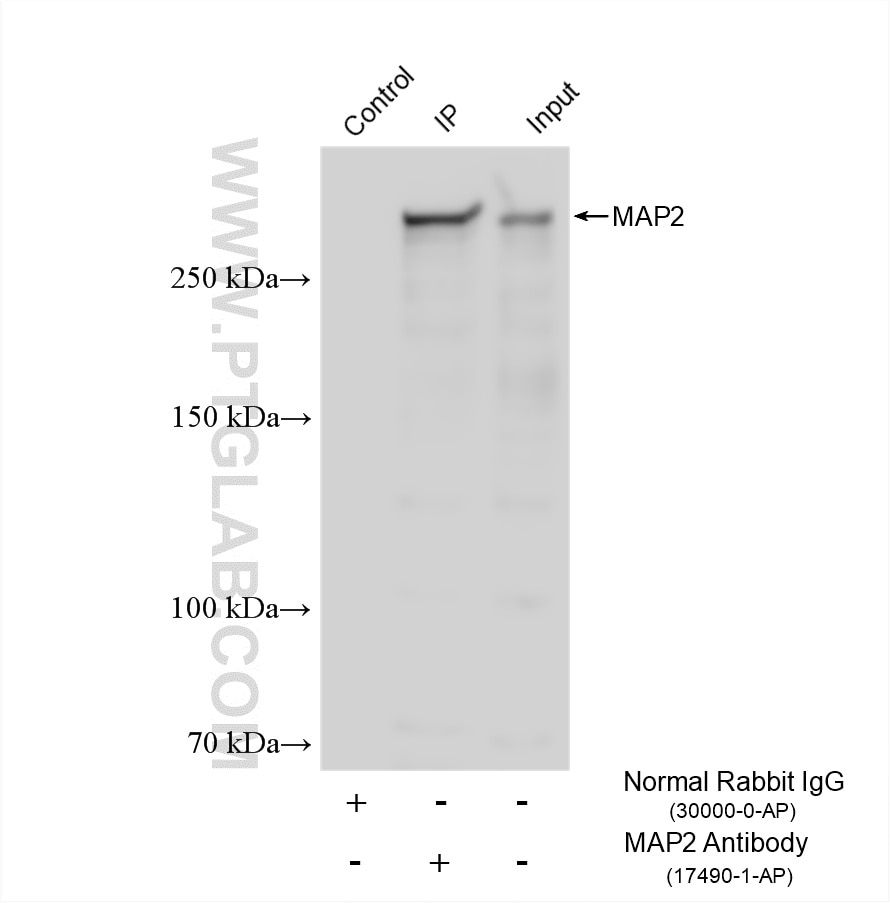 IP experiment of mouse brain using 17490-1-AP Immunoprecipitation (IP) experiment of mouse brain tissue using MAP2 Polyclonal antibody (17490-1-AP)