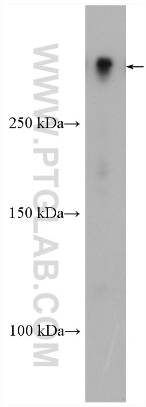 Western Blot (WB) analysis of rat brain tissue using MAP2 Polyclonal antibody (17490-1-AP)