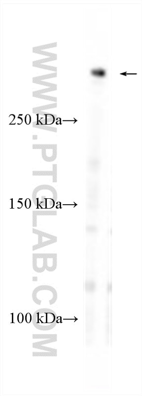 Western Blot (WB) analysis of mouse brain tissue using MAP2 Polyclonal antibody (17490-1-AP)