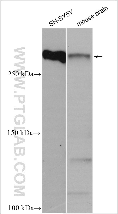 Western Blot (WB) analysis of various lysates using MAP2 Polyclonal antibody (17490-1-AP)