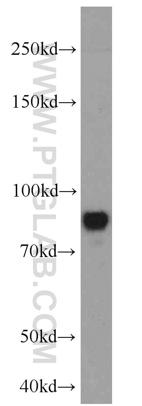 Western Blot (WB) analysis of SH-SY5Y cells using MAP2 Polyclonal antibody (17490-1-AP)