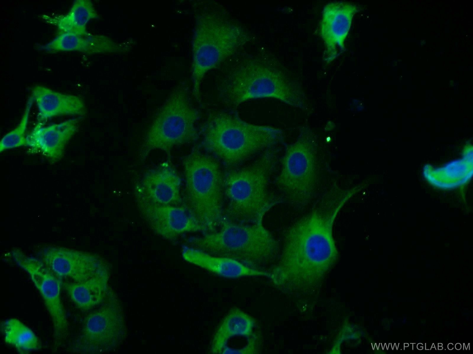 Immunofluorescence (IF) / fluorescent staining of SH-SY5Y cells using MEK1/2 Polyclonal antibody (11049-1-AP)