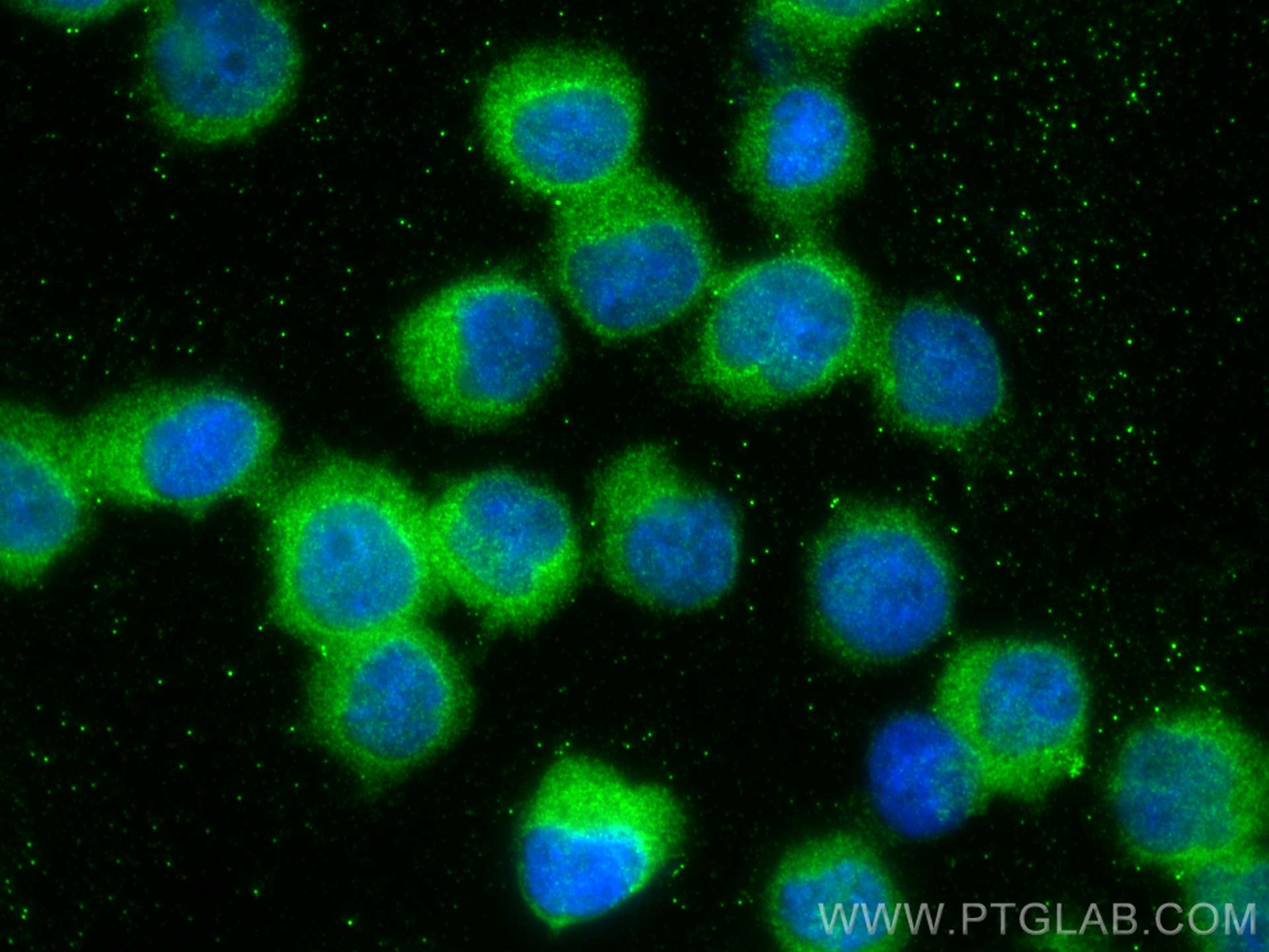 Immunofluorescence (IF) / fluorescent staining of Jurkat cells using MEK1/2 Polyclonal antibody (11049-1-AP)