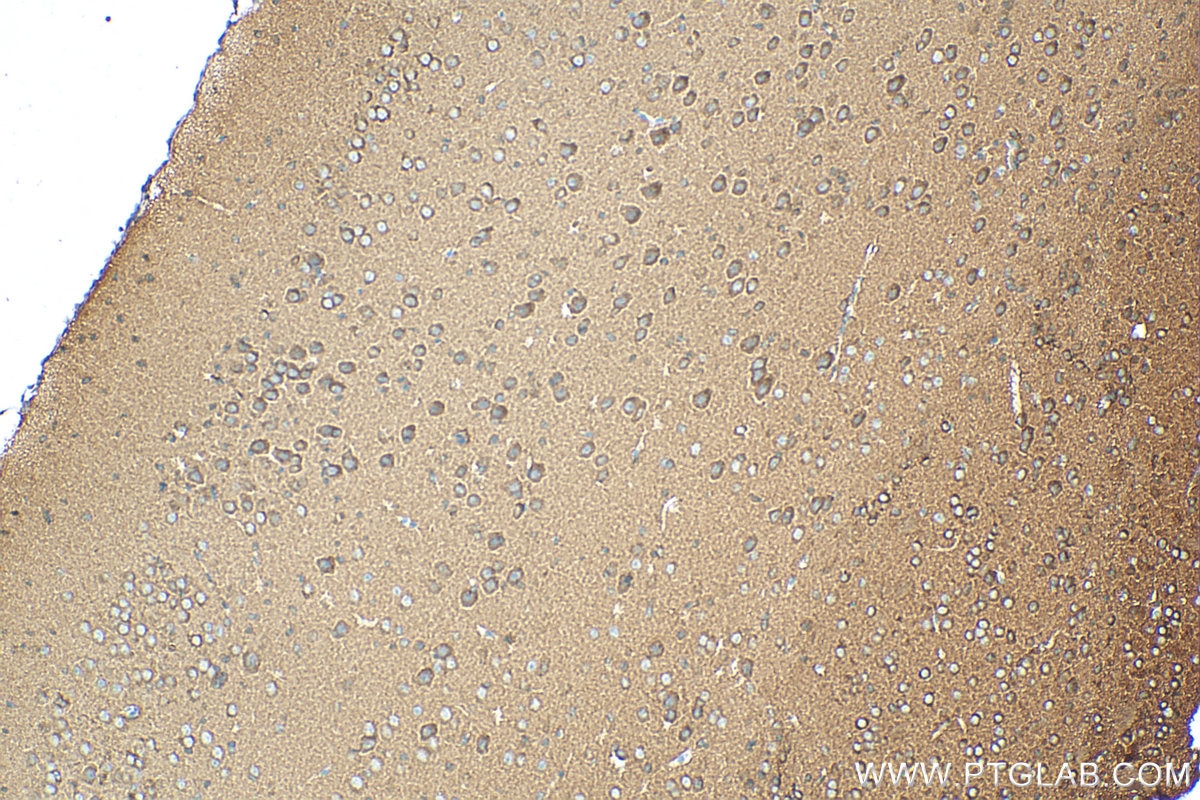IHC staining of mouse brain using 11049-1-AP