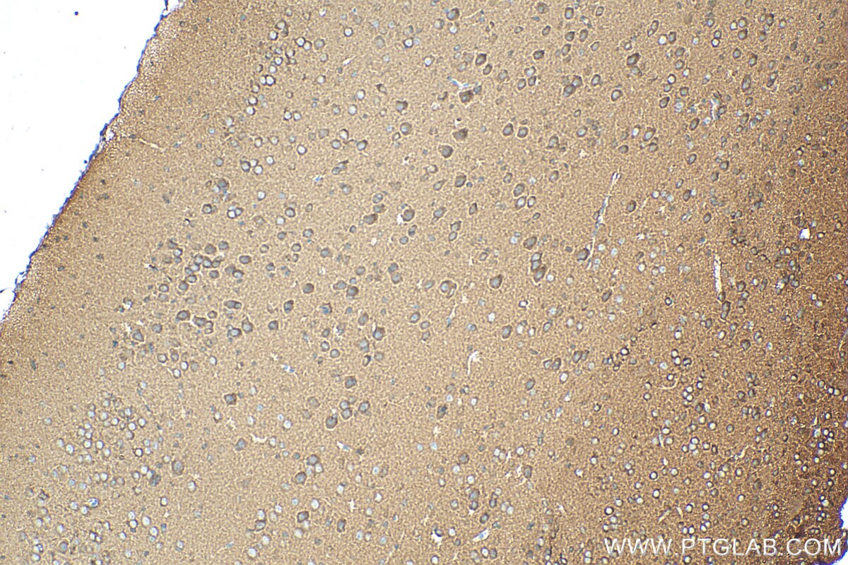 Immunohistochemistry (IHC) staining of mouse brain tissue using MEK1/2 Polyclonal antibody (11049-1-AP)