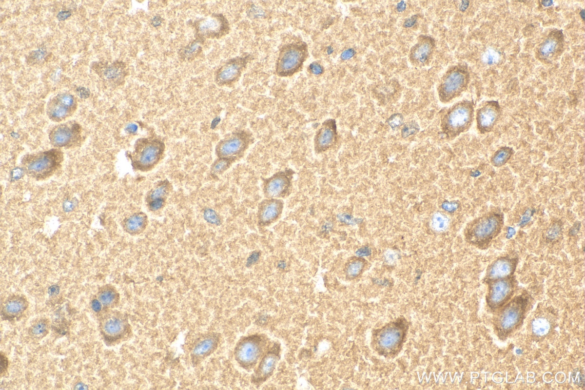 Immunohistochemistry (IHC) staining of mouse brain tissue using MEK1/2 Polyclonal antibody (11049-1-AP)