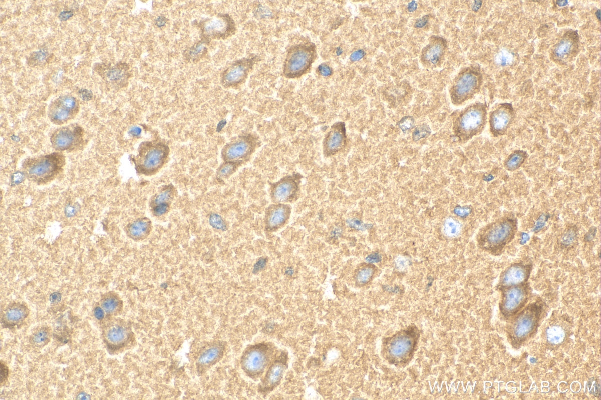 IHC staining of mouse brain using 11049-1-AP