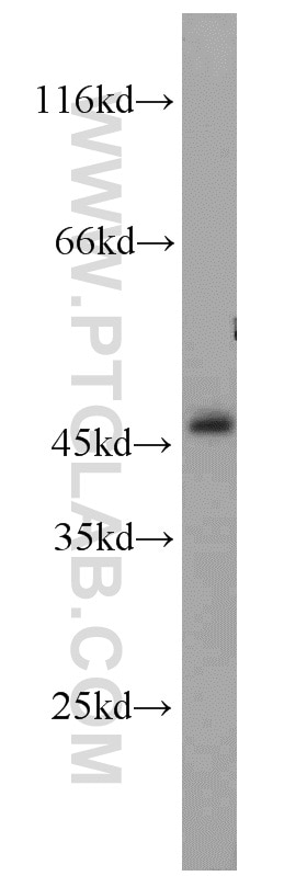 Western Blot (WB) analysis of human brain tissue using MEK1/2 Polyclonal antibody (11049-1-AP)