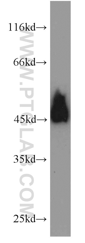 Western Blot (WB) analysis of Jurkat cells using MEK1/2 Polyclonal antibody (11049-1-AP)