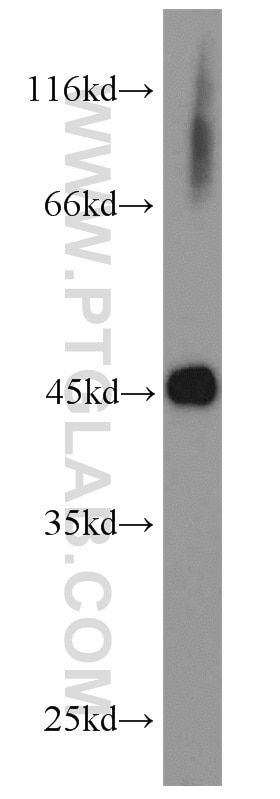 Western Blot (WB) analysis of SH-SY5Y cells using MEK1/2 Polyclonal antibody (11049-1-AP)