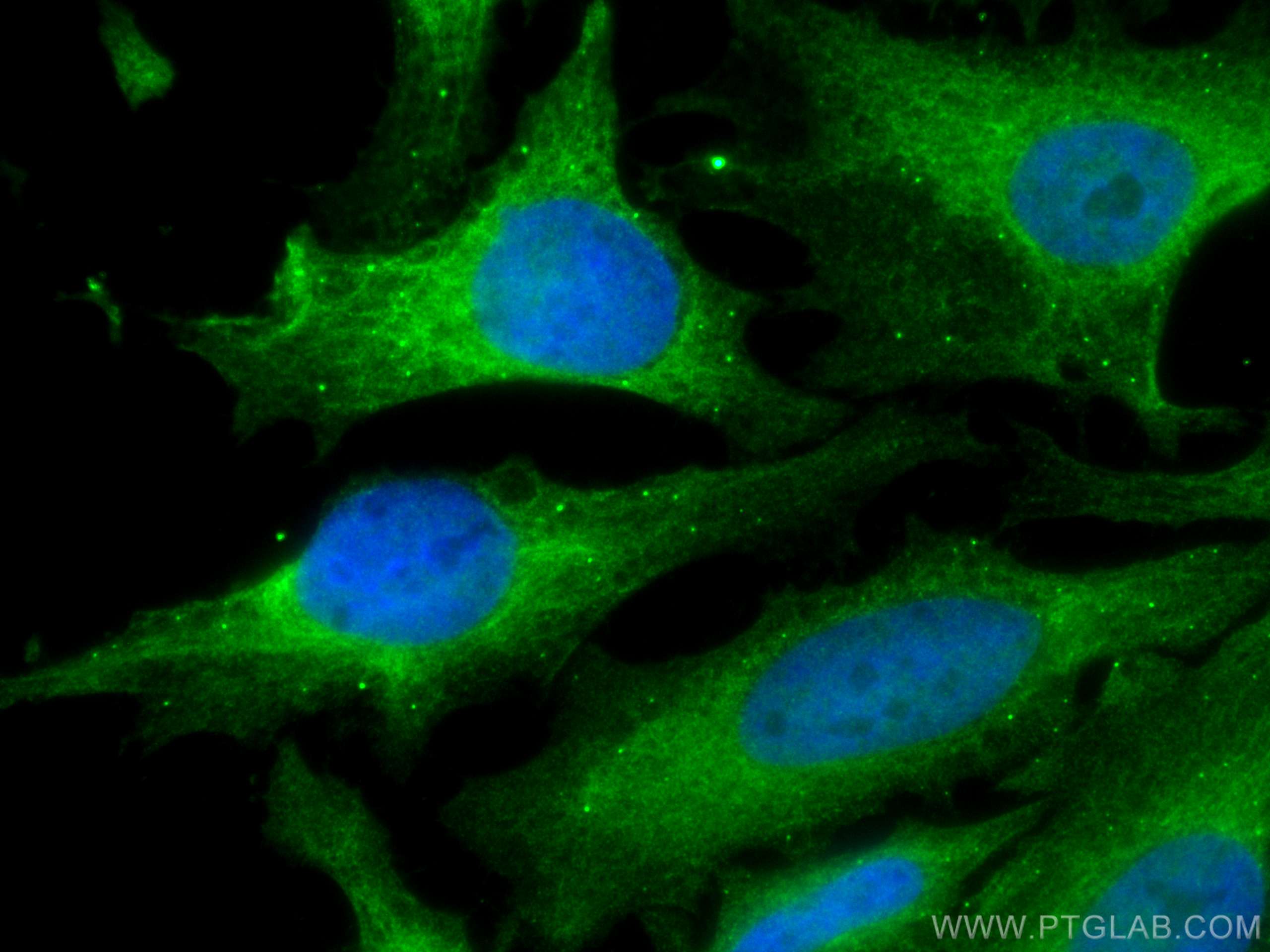 Immunofluorescence (IF) / fluorescent staining of HeLa cells using MEK2 Monoclonal antibody (67410-1-Ig)