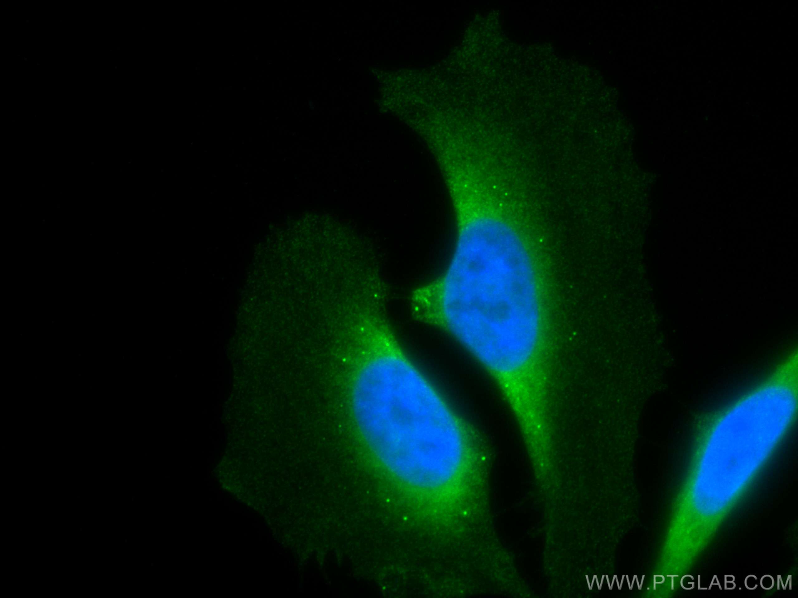 Immunofluorescence (IF) / fluorescent staining of HeLa cells using CoraLite® Plus 488-conjugated MEK2 Monoclonal anti (CL488-67410)