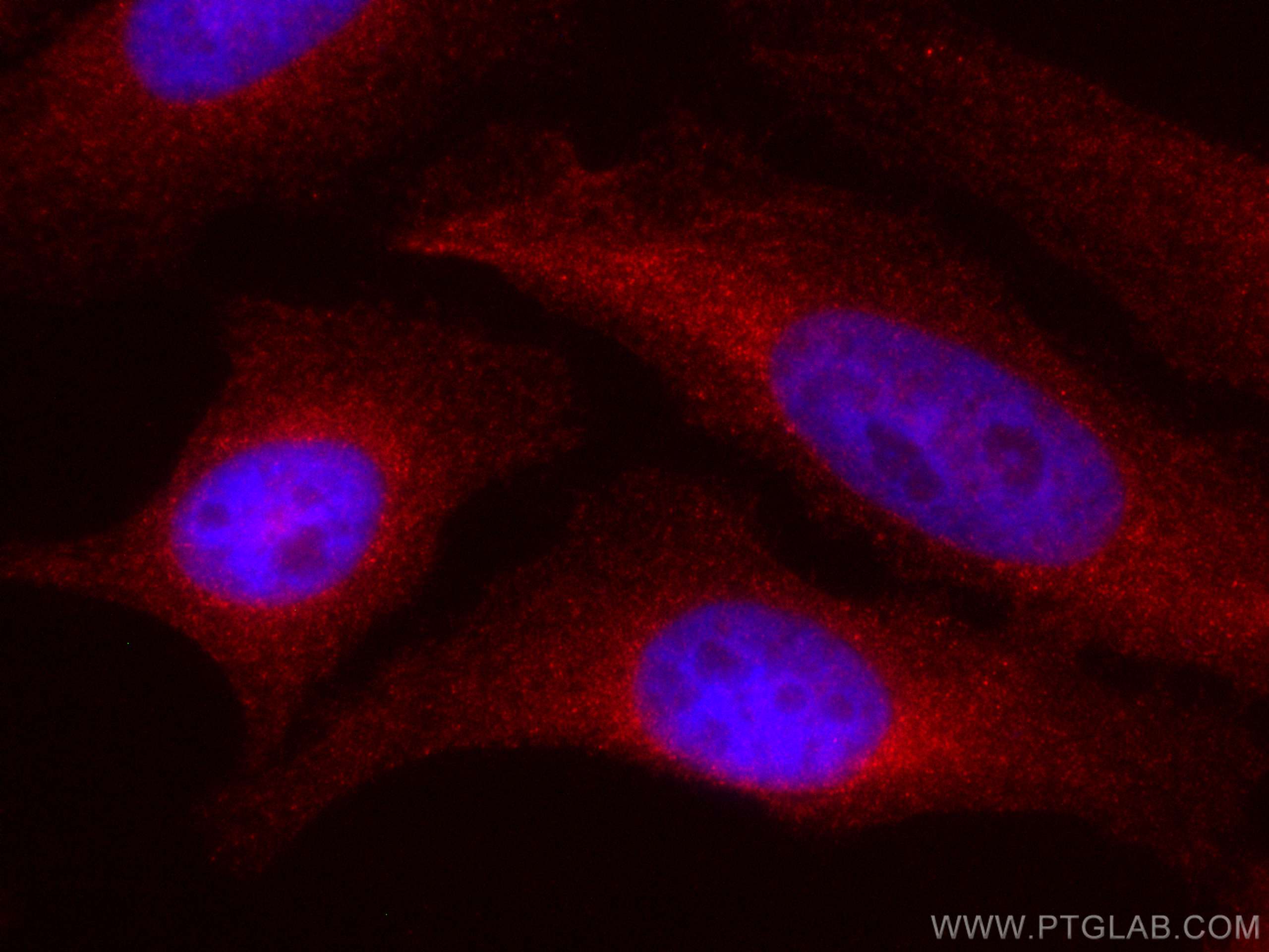 Immunofluorescence (IF) / fluorescent staining of HeLa cells using CoraLite®594-conjugated MEK2 Monoclonal antibody (CL594-67410)