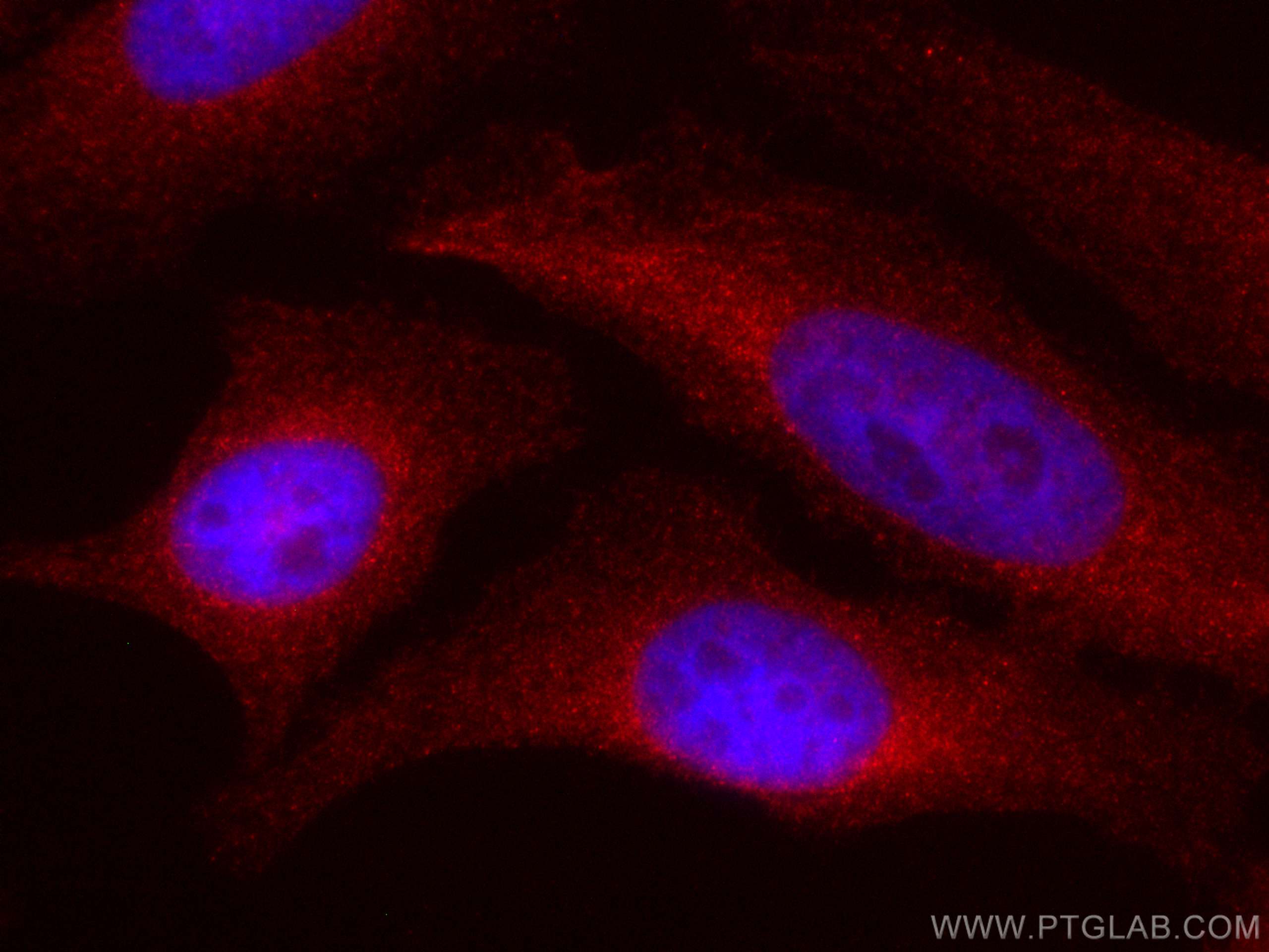 IF Staining of HeLa using CL594-67410