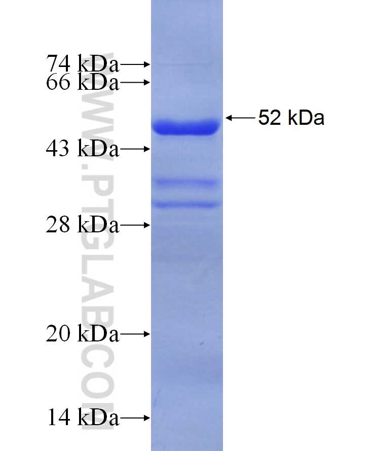 MAP2K2 fusion protein Ag29871 SDS-PAGE