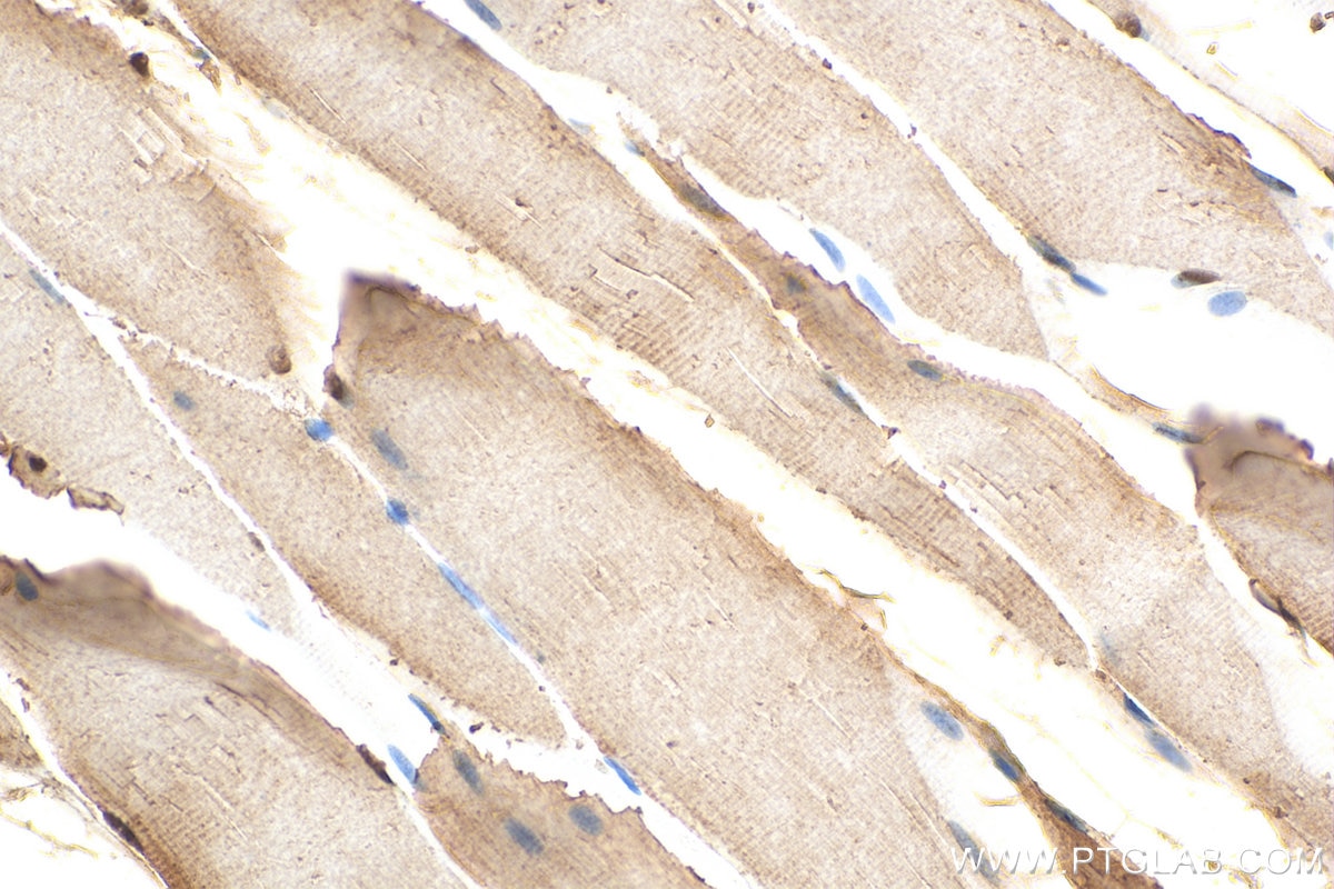 Immunohistochemistry (IHC) staining of rat skeletal muscle tissue using MEK3 Polyclonal antibody (13898-1-AP)