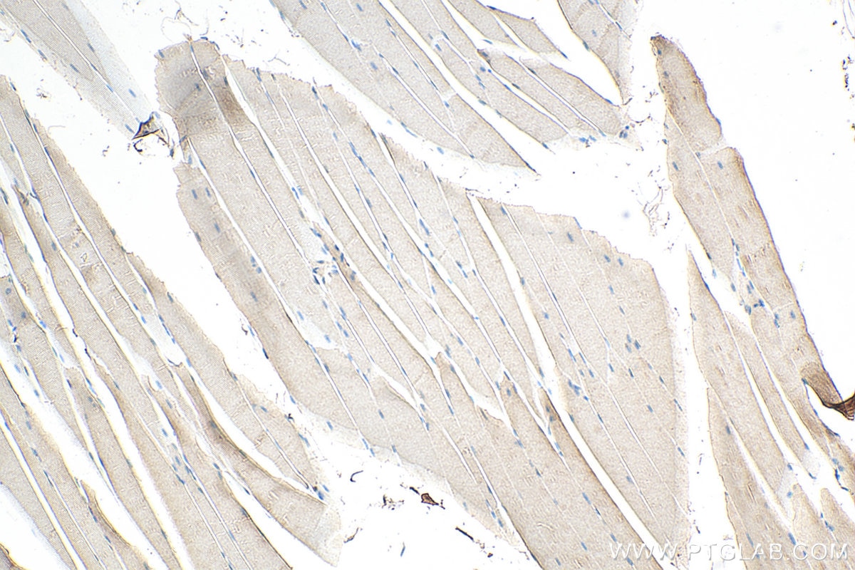 Immunohistochemistry (IHC) staining of mouse skeletal muscle tissue using MEK3 Polyclonal antibody (13898-1-AP)