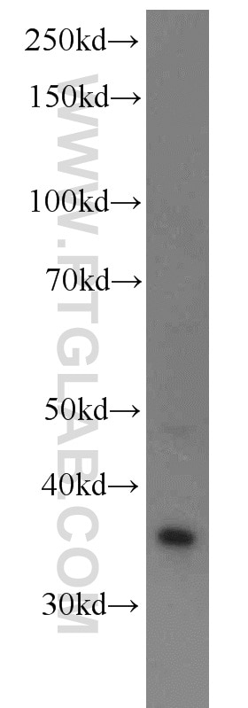 WB analysis of HeLa using 13898-1-AP