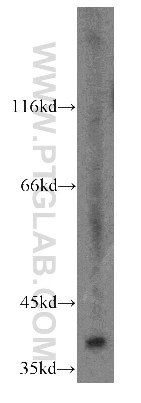 Western Blot (WB) analysis of HeLa cells using MEK3 Polyclonal antibody (13898-1-AP)