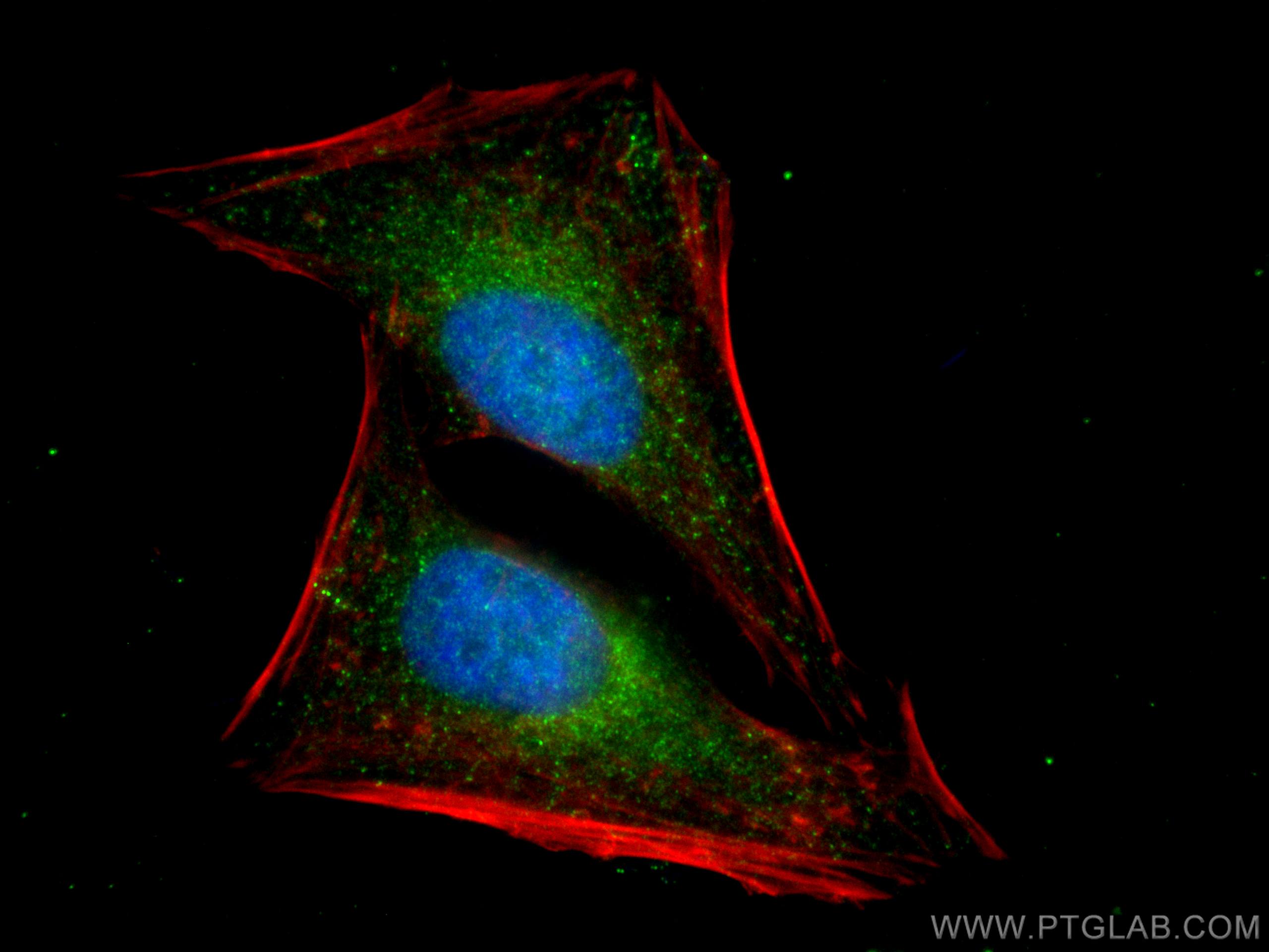 Immunofluorescence (IF) / fluorescent staining of HeLa cells using MAP2K3 Recombinant antibody (80137-1-RR)