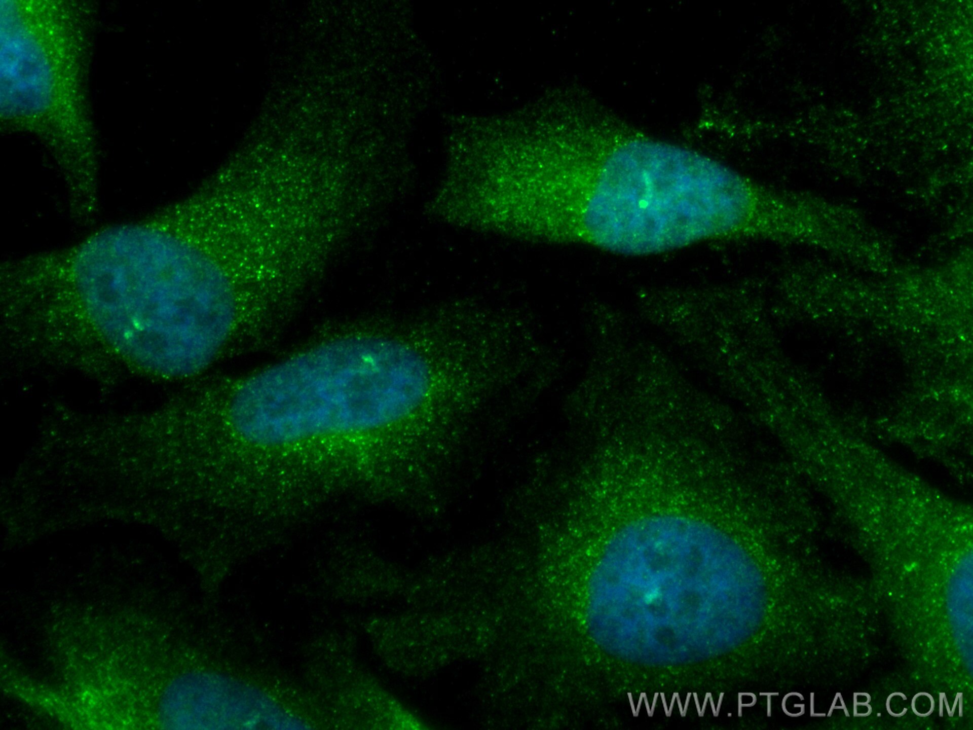 Immunofluorescence (IF) / fluorescent staining of HeLa cells using CoraLite® Plus 488-conjugated MAP2K3 Recombinant a (CL488-80137)