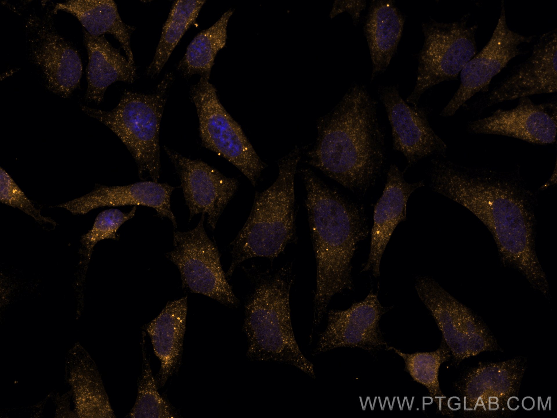 Immunofluorescence (IF) / fluorescent staining of HeLa cells using CoraLite®555-conjugated MAP2K3 Recombinant antibod (CL555-80137)