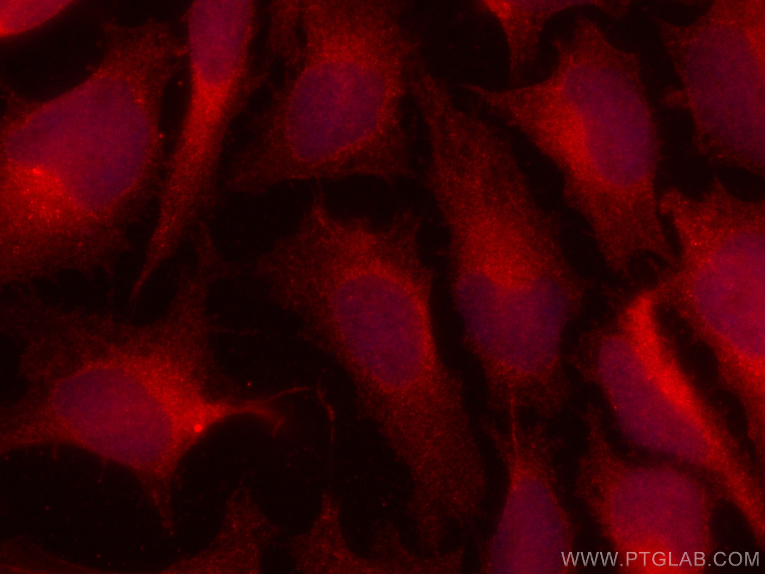 Immunofluorescence (IF) / fluorescent staining of HeLa cells using CoraLite®594-conjugated MAP2K3 Recombinant antibod (CL594-80137)