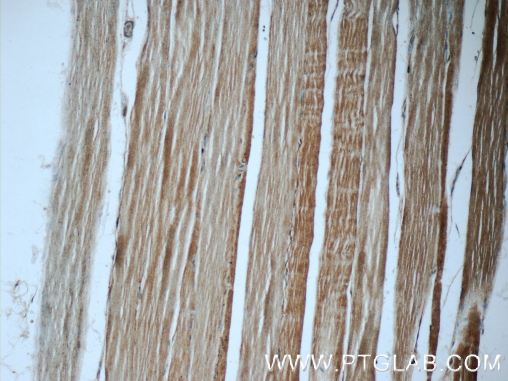 IHC staining of human skeletal muscle using 17340-1-AP