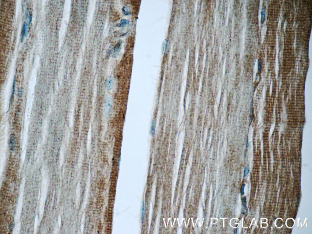 Immunohistochemistry (IHC) staining of human skeletal muscle tissue using MAP2K4 Polyclonal antibody (17340-1-AP)