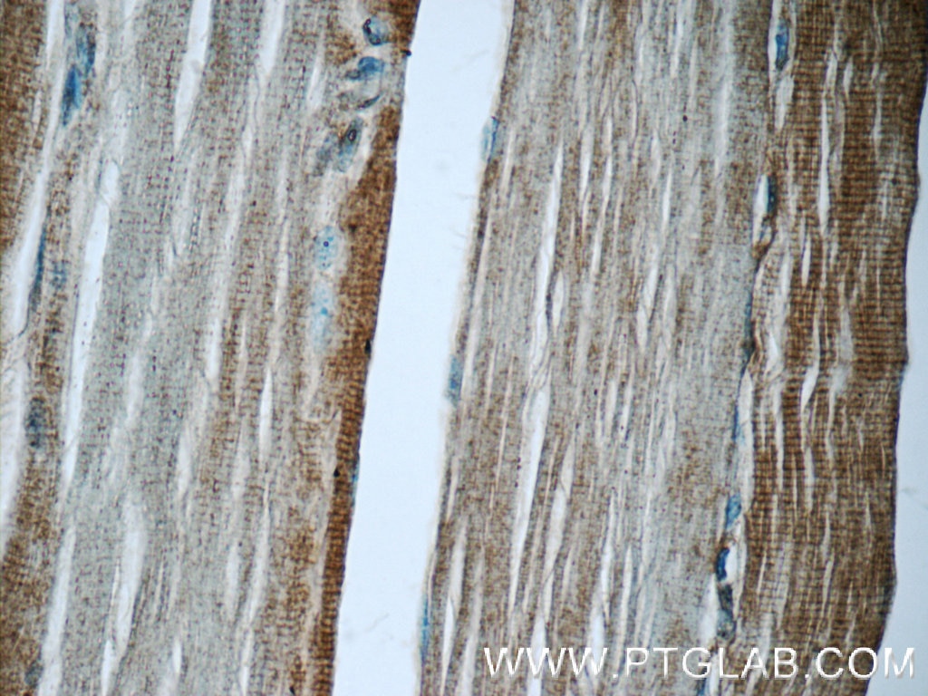 IHC staining of human skeletal muscle using 17340-1-AP