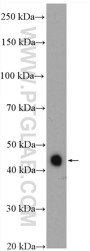 Western Blot (WB) analysis of HeLa cells using MAP2K4 Polyclonal antibody (17340-1-AP)